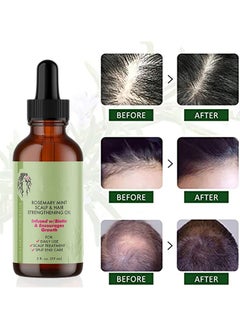 DubaiGallery Rosemary Hair Growth Essential Oil Anti Hair Loss Fast Regrowth Essence Aromatherapy Repair Damaged Frizzy30ml  - Image 1
