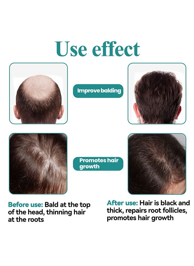 EELHOE - Destined For Density - Hair Growth Serum, Biotin Hair Regrowth Oil Prevent Hair Loss And Helps Hair Thicker, Stronger, Longer Hair Treatment Men And Women 45ML - Image 1