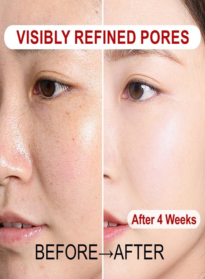 Venrock Pore Refining & Polishing Essence with 4% Niacinamide - Minimizing Serum for Large Pores, Blackheads & Oily Skin, Micro-Bubble Radiance Treatment, 1.01 Fl Oz - Image 5