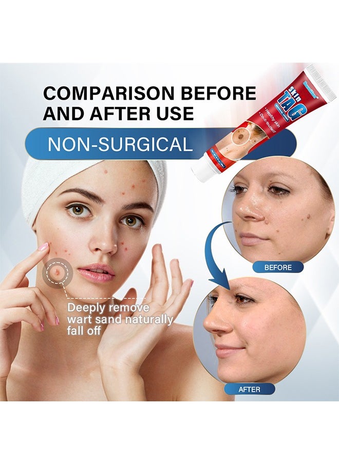 Sumifun - Wart Remover Ointment 20g - Natural Ingredients for Safe Body Wart Treatment, Acne, Moles, and Scar Reduction, Remove Moles and Smooth Skin - Image 1