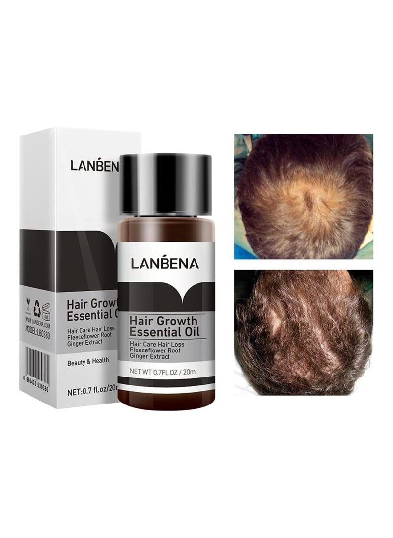 LANBENA Hair Growth Essence Fast Powerful Hair Care Essential Oil Treatment Preventing Hair Loss 20ml  - Image 5
