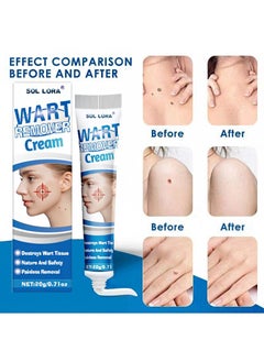 SOL LORA 2 Pieces Of Wart Remover Cream, Natural Herbal Wart And Mole Removal Ointment, Can Be Used On Any Part Of The Body  - Image 2