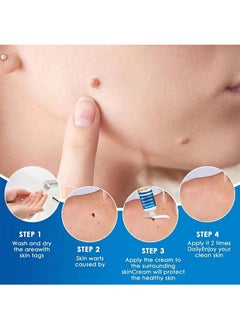 SOL LORA 2 Pieces Of Wart Remover Cream, Natural Herbal Wart And Mole Removal Ointment, Can Be Used On Any Part Of The Body  - Image 4