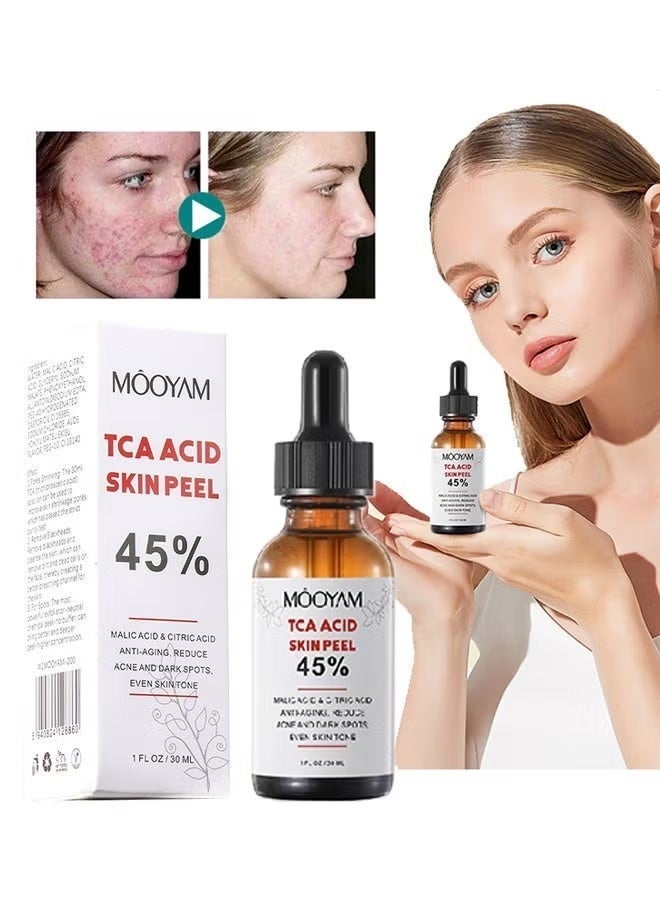 موويام 45٪ حمض TCA لتقشير البشرة - حمض الماليك وحمض الستريك، مضاد للشيخوخة، يقلل من حب الشباب والبقع الداكنة، يوحد لون البشرة، 45٪ حمض TCA لتقشير البشرة، 45٪ سيروم تقشير كيميائي بحمض الماليك وحمض الستريك للبشرة الداكنة والبقع الداكنة وبقع حب الشباب، عناية طبيعية بالبشرة - 30 مل/1 أونصة سائلة - Image 1