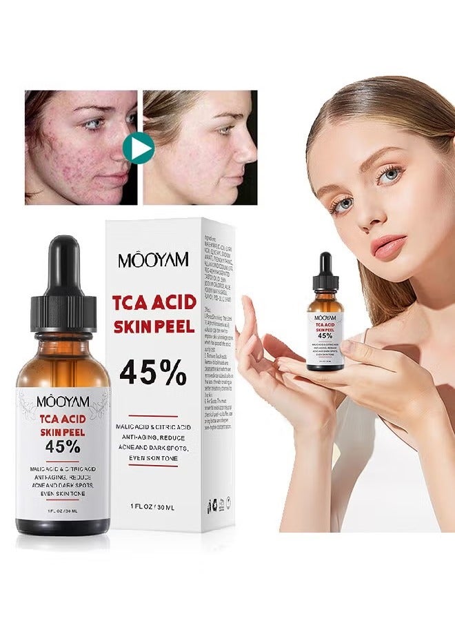 MOOYAM 45% TCA Acid Skin Peel - Malic Acid & Citric Acid, Anti-Aging, Reduce Acne and Dark Spots, Even Skin Tone, TCA 45% Skin Peel, 45% TCA Chemical Peeling Serum with Malic and Citric Acid for Dark Skin, Dark Spots and Acne Spots, Natural Skin Care - 30 ml/1 fl oz - Image 1