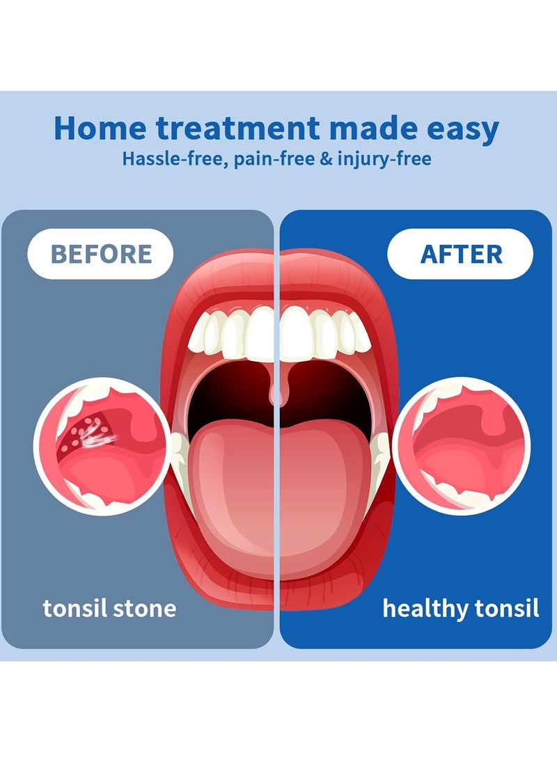 Electronic Tonsil Stone Remover Vacuum, 10-in-1 Tonsil Stone Removal Kit, Built-in Blue Light Vacuum, Easy to Use, Fight Bad Breath, Oral Cleaning and Care - Image 4
