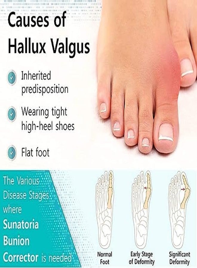 Dingger Toe Separator for Feet Toe Spacers Correct Toes Yoga Silicone Hammer Toe Corrector for Women & Men Correct Toe Straighteners for Overlapping Toes (All Finger Toe Separator) - Image 3