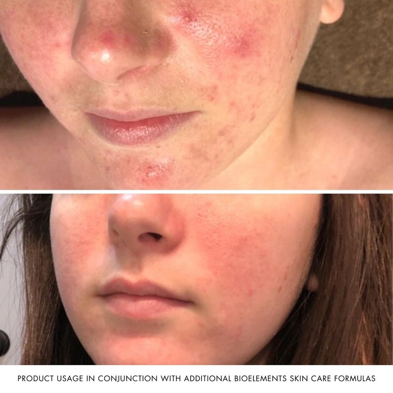 Bioelements Measured Micrograins + - 4 fl oz - Multi-Action Facial Scrub for All Skin Types - Featuring Natural Jojoba Beads in a Clay Creme - Vegan, Gluten Free - Never Tested on Animals - Image 5