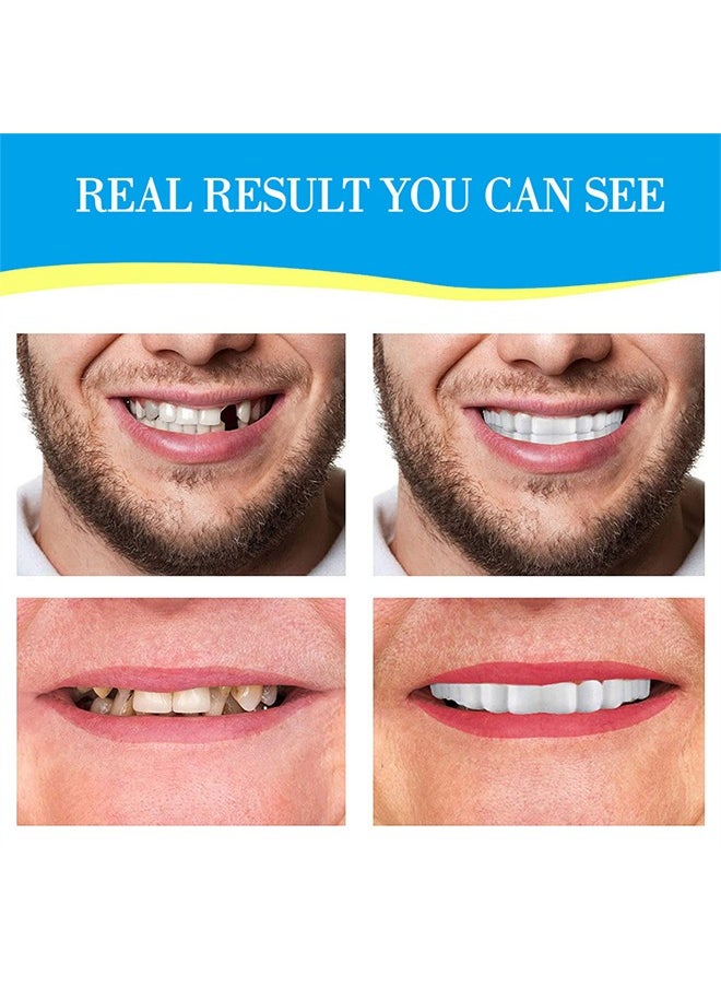 Crazylife - Instant Veneers Dentures, Upper Lower Teeth Artificial Dentures Silicone Prosthetic Teeth Decoration, Cosmetic Veneers Teeth Temporary Fake Teeth Smile Teeth Veneers, for Men Women with Bad Teeth - Image 1