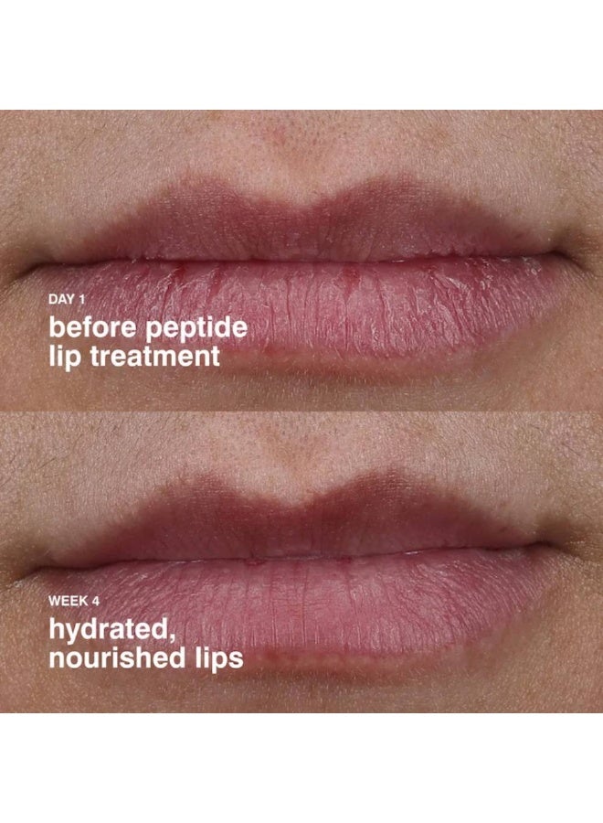 rhode علاج الشفاه بالببتيد 10 مل - زجاجة الفراولة - Image 3