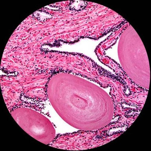 AmScope AmScope PS25 Prepared Microscope Slide Set for Basic Biological Science Education, 25 Slides, Includes Fitted Wooden Case Brown - Image 2