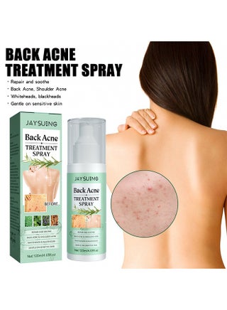 Back Acne Treatment Spray120ml -Tea Tree Oil Spray,Body Acne Treatment with Herbal Formula, Acne Treatment For Teens, Back Acne - pzsku/Z8B0FDA915DD976681C53Z/45/_/1716608258/2e19ec4c-85b9-4696-9870-6cac2d342435