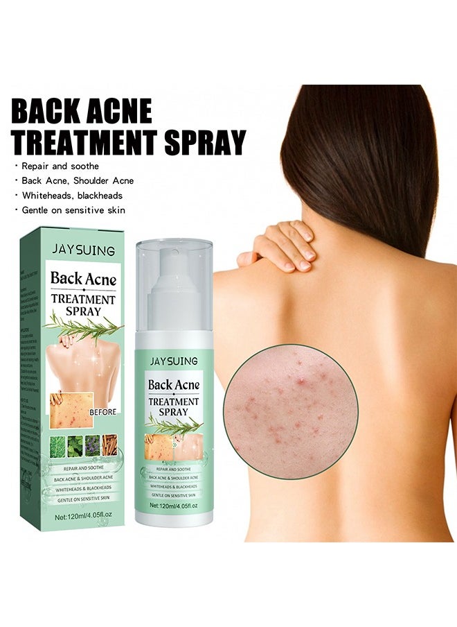 Jaysuing - Back Acne Treatment Spray120ml -Tea Tree Oil Spray,Body Acne Treatment with Herbal Formula, Acne Treatment For Teens, Back Acne - Image 1