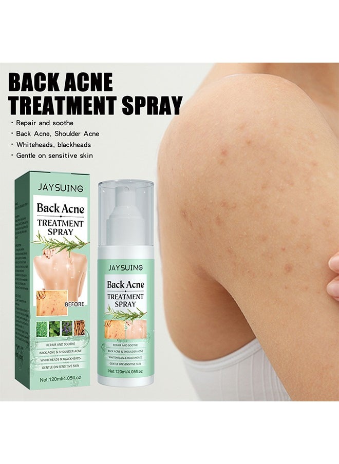 Jaysuing - Back Acne Treatment Spray120ml -Tea Tree Oil Spray,Body Acne Treatment with Herbal Formula, Acne Treatment For Teens, Back Acne - Image 1