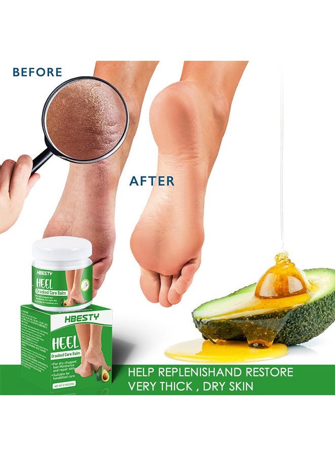 HBESTY Heel Cracked Care Balm with Avocado Extract Foot Moisturizer for Dry Cracked Feet Knees Elbows Hands Foot Care for Softens Skin Exfoliates Dead Skin Smoothing Skin for Women and Men 20G - Image 2