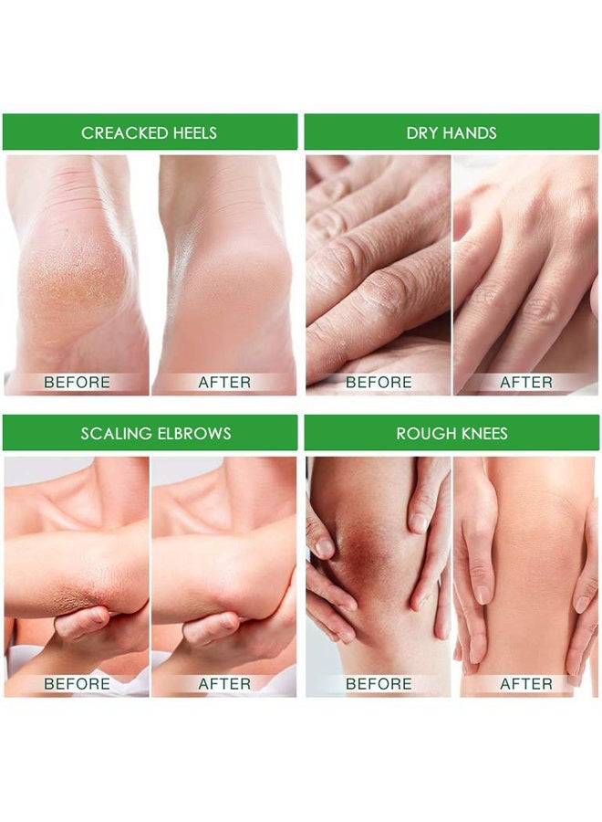 HBESTY Heel Cracked Care Balm with Avocado Extract Foot Moisturizer for Dry Cracked Feet Knees Elbows Hands Foot Care for Softens Skin Exfoliates Dead Skin Smoothing Skin for Women and Men 20G - Image 5