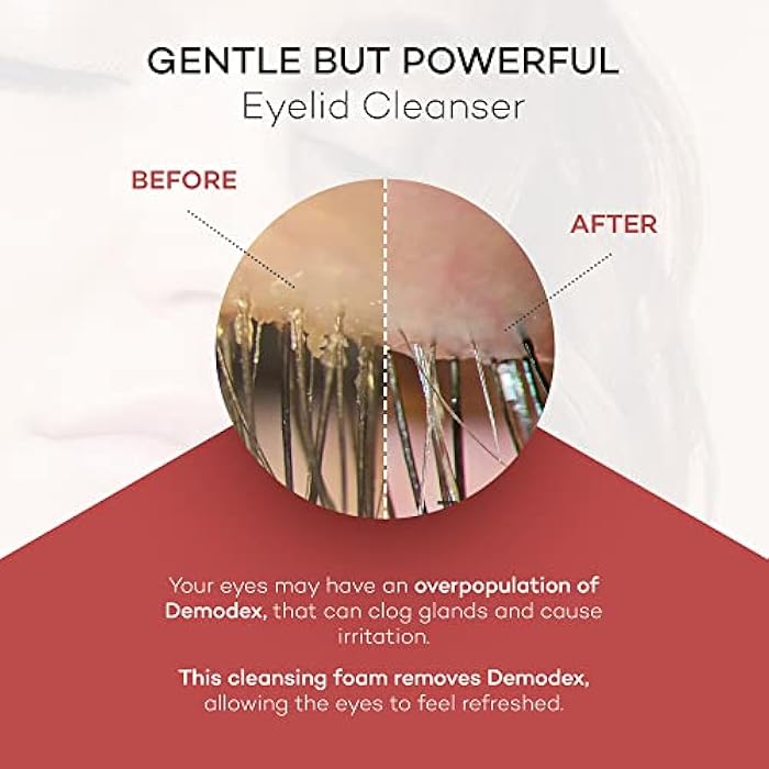 Zocular ZocuFoam Eyelid Cleanser - Foaming Eyelid Scrub - Natural pH Balanced Solution - 1.7 FL OZ (50mL) - Image 5