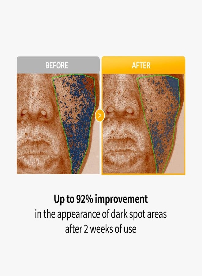ESSL Arvitathion Brightoning Patch | Dark Spot Patches with Arbutin, Glutathione, Squalane, AHA & BHA | Visibly Reduce Dark Spots & Uneven Skin Tone | Korean Skin Care | 8 Count - Image 2