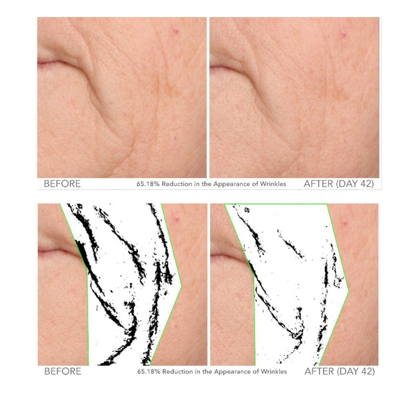 Serious Skincare - Beyond Intensive Vitamin C Serum for Face - 60 Day Facial Treatment for Healthy Glowing Skin and Brightening - Smoothes Lines, Pores and Fades Dark Spots - 2 Piece Anti-Aging Set - Image 3