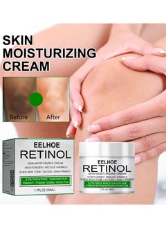 EELHOE Retionl Skin Moisturizing Cream for Deeply Hydrates,Firms,Moisturizes,Removes Acne Scars  - Image 1