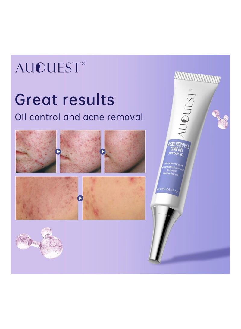 AuQuest Acne Remoyal Gure Gel, Herbal Acne Treatment Cream, Smooth And Gentle Pimple Spot Removal, Safe And Effective Skin Care Beauty Cream For Teen Womens, (1pc) - Image 3