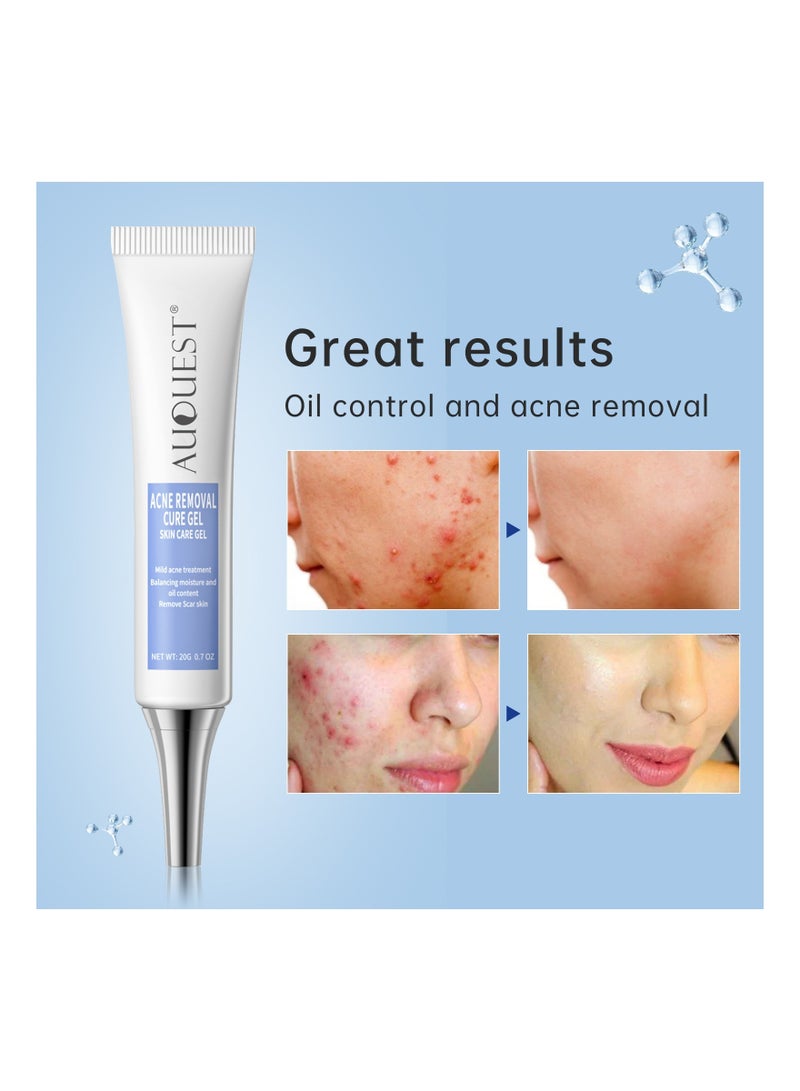 AuQuest Acne Remoyal Gure Gel, Herbal Acne Treatment Cream, Smooth And Gentle Pimple Spot Removal, Safe And Effective Skin Care Beauty Cream For Teen Womens, (1pc) - Image 4