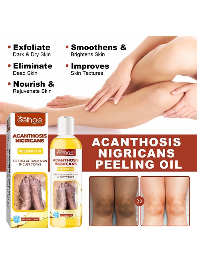 إيلهو زيت تقشير الشواك Nigricans ، مقشر كيميائي للوجه والجسم ، يقلل من التجاعيد وعلامات التمدد ، زيت تقشير أصفر لجميع أنواع البشرة ، محلول تقشير مقشر (110 مل) - Image 4