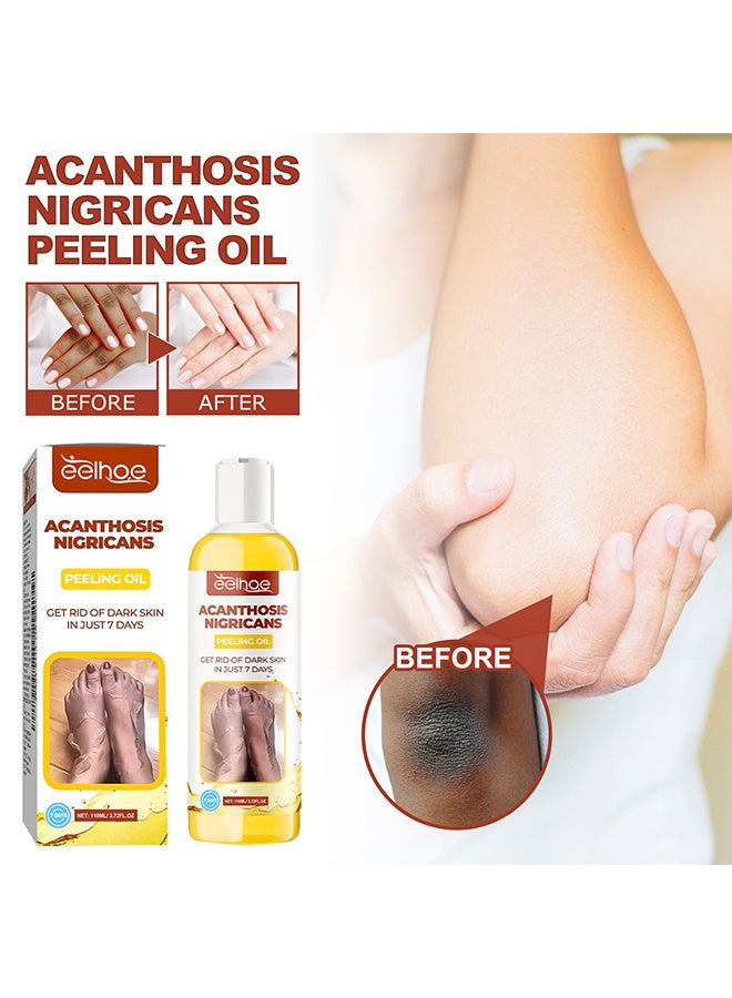 إيلهو زيت تقشير الشواك Nigricans ، مقشر كيميائي للوجه والجسم ، يقلل من التجاعيد وعلامات التمدد ، زيت تقشير أصفر لجميع أنواع البشرة ، محلول تقشير مقشر (110 مل) - Image 1