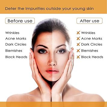 NUTRIGLOW مجموعة وجه نوتريغلو من البابايا لبشرة أكثر صفاءً خالية من العيوب بشرة مرطبة وأكثر إشراقًا مظهر منعش لجميع أنواع البشرة 260 جرام - Image 4