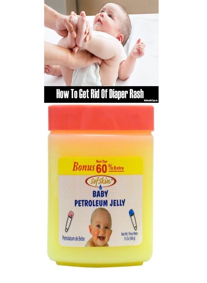 SOFSKIN (USA Brand) BABY PETROLEUM JELLY 368 GM, for Baby Diaper Rash, Perfumed, 100% Pure & Safe. pH 5.5, No skin allergy, (See Video) - Image 1