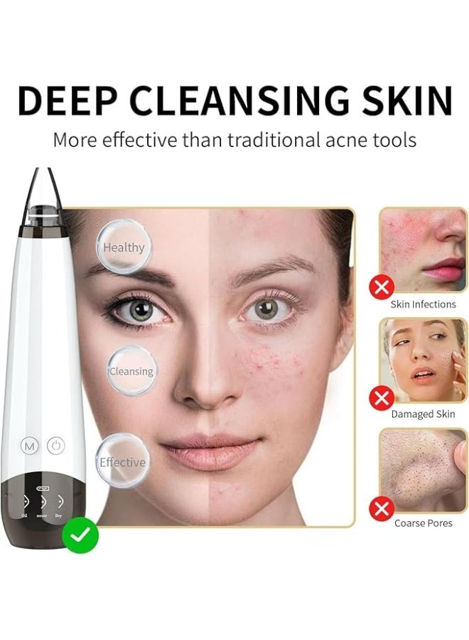 YelaJoy Yalla Joy Electric Blackhead Remover Vacuum with Multiple Suction Levels – Pore Cleaner and Facial Skin Extractor for Removing Oil, Dirt, Dead Skin, and Acne – Complete Blackhead Removal Tool Set for Smooth and Clear Skin - Image 3