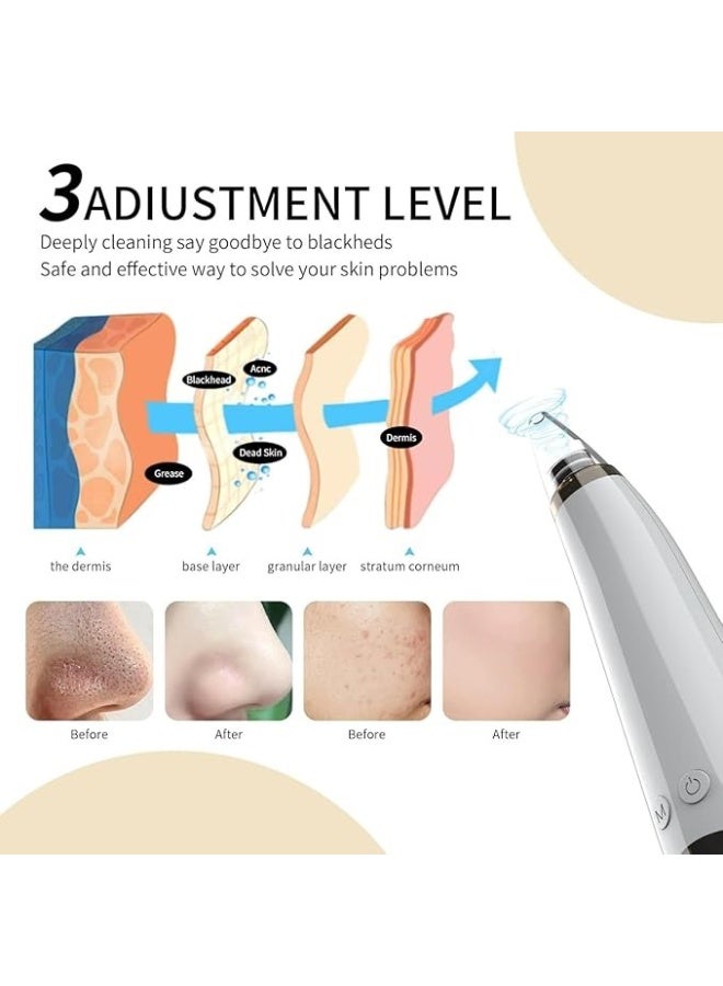 YelaJoy Yalla Joy Electric Blackhead Remover Vacuum with Multiple Suction Levels – Pore Cleaner and Facial Skin Extractor for Removing Oil, Dirt, Dead Skin, and Acne – Complete Blackhead Removal Tool Set for Smooth and Clear Skin - Image 4