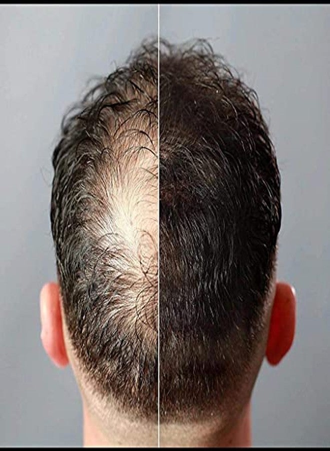 جوفينايل ألياف تكثيف الشعر للأطفال، أسود، 25 غرام، ألياف مكثفة للشعر الخفيف والصلع، للرجال والنساء - Image 5