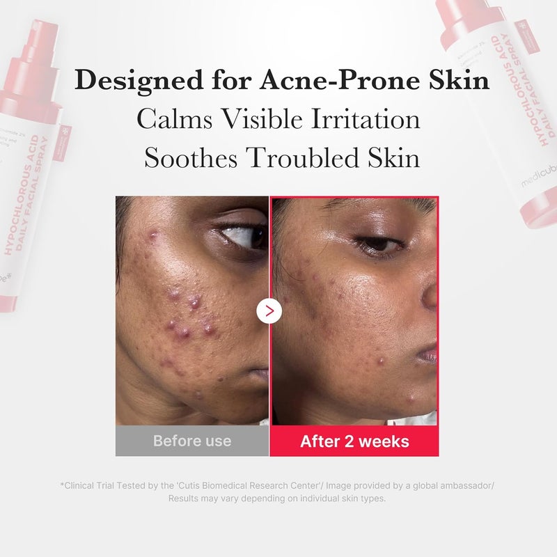 Medicube Power Soothing Spray with 2% Niacinamide & Hypochlorous Acid (125ml), pH Balanced Calming Facial Mist for Sensitive Skin, Hydrating & Purifying Face Spray for Redness Relief, Fragrance Free Non Comedogenic Daily Mist - Image 5