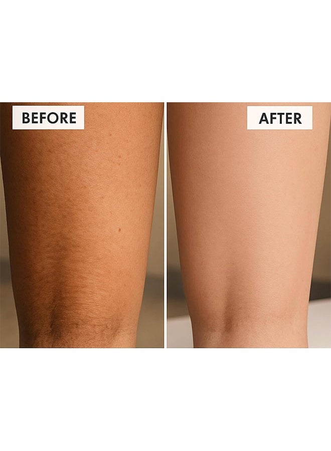 Replenix Discoloration Glycolic Acid 15% Resurfacing Body Lotion 200ml, Medical Grade Ingredients Acid Exfoliating Cream, Antioxidant Treatment Smooths Skin Texture, Suitable For Sensitive Skin - Image 4