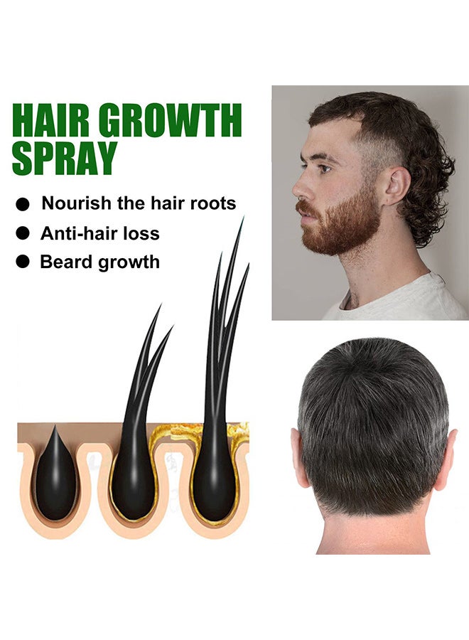 إيلهو Ginger Hair growth spray, Rapid Growth Hair Treatment 7 Day Hair Growth Serum Essence Oil Regrow, Ginger Essential Oil Stop Hair Loss Hair, Thinning Treatment Hair Growth Oil for Women  Men 20ML - Image 2