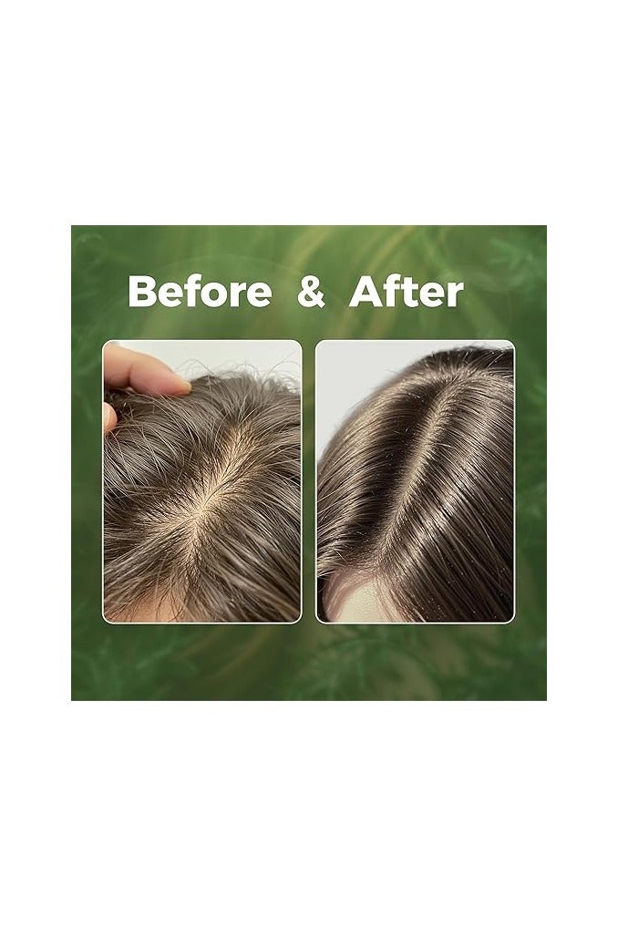 By Nature سيروم الشعر من باي ناتشر بالروزماري والنعناع – 50 مل، سيروم مغذي للتحكم في التجاعيد واللمعان - Image 5