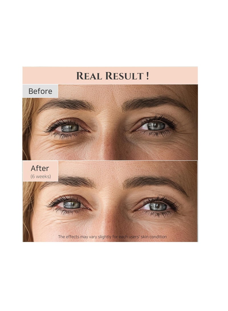 Beauty of Joseon 3 Piece Revive Eye Serum : Ginseng + Retinal Pink 30mlml - Image 4