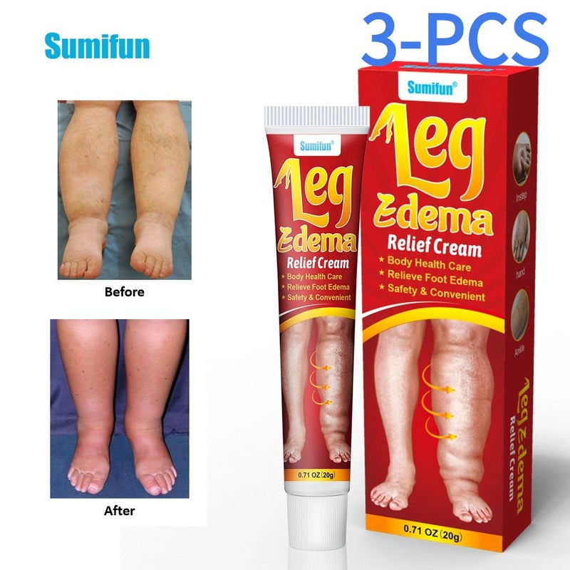 سوميفون كريم تخفيف وذمة الساق - 3 قطع ، تخفيف وذمة القدم ، السلامة والملاءمة - Image 1