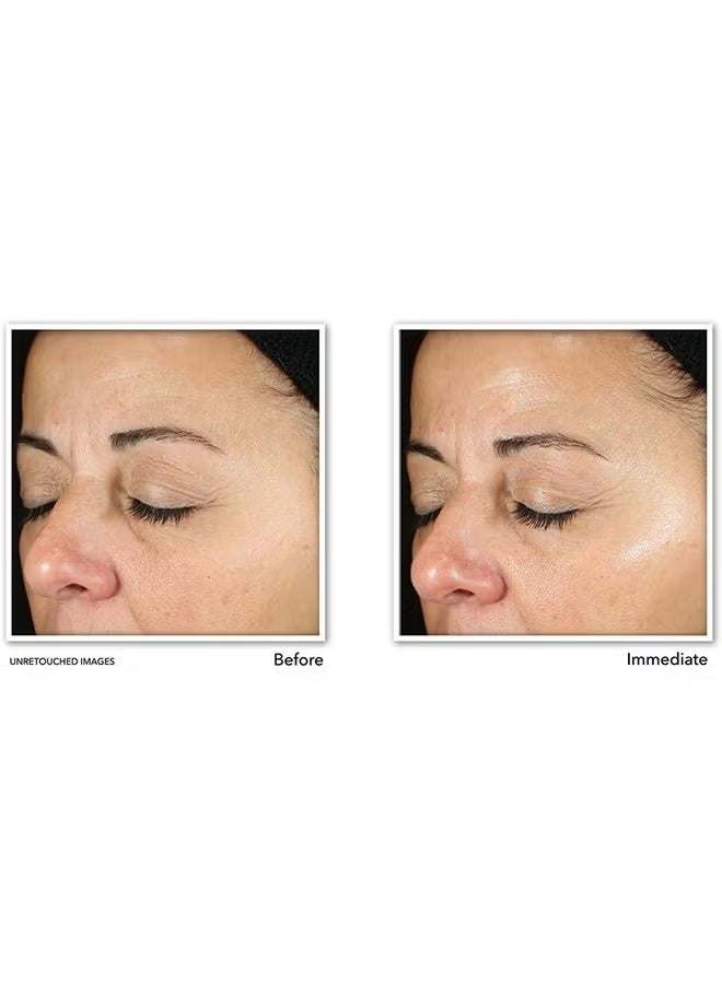 روك سيروم يومي متعدد التصحيح، إحياء وتوهج، فيتامين سي، سيروم فيتامين سي للوجه، سيروم مضاد للشيخوخة، سيروم تفتيح البشرة، سيروم للوجه لإزالة بقع تغير اللون، 30 مل - Image 3