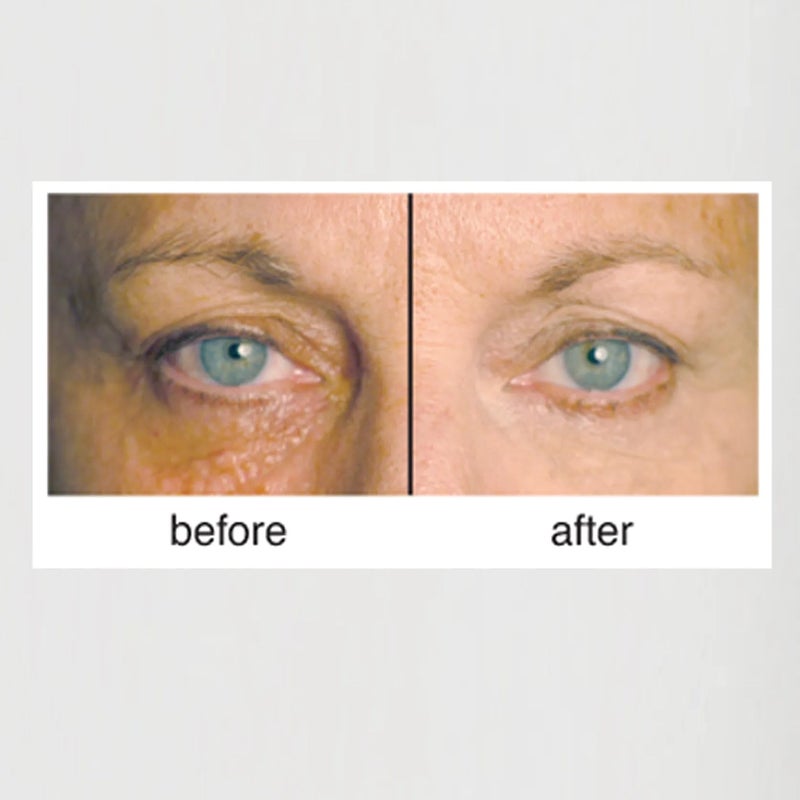 Clientele Peptide Wrinkle Concealer Compact Neutral - Image 2