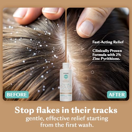 DHS Zinc Shampoo – Dandruff Shampoo – for Flaky and Dry Scalp with 2% Zinc Pyrithione, 8 oz - Image 3