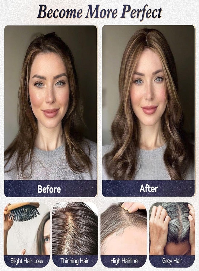 starluck Real Human Hair Toppers for Women 10Inch-Suitable for Thinning Hair no Bangs 3 * 4.5inches Swiss Base Hand-Tied & 3 Secure Clips(Ash Blonde) - Image 4