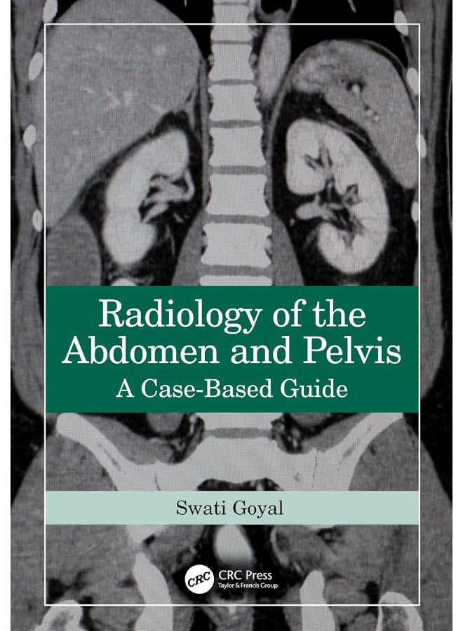 Radiology of the Abdomen and Pelvis: A Case-Based Guide