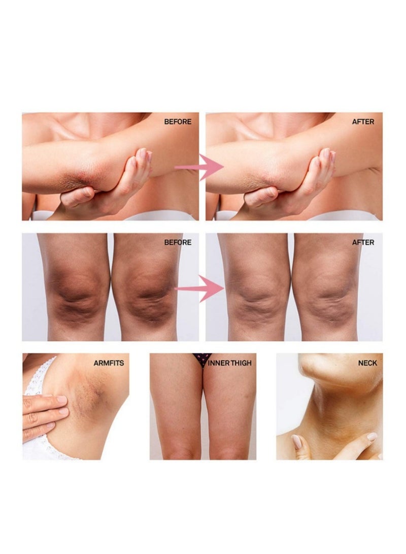 Underarm Whitening Cream，Underarm Body Cream Niacinamide Body Lotion，Snow Bleach Skin Whitening ，Private Part Whitening，Intimate Area Whitening， Body Skin Bleaching 50ml