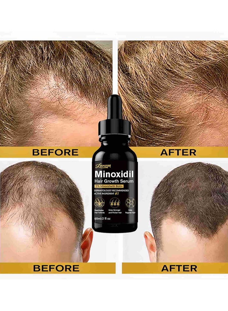 LUNOON 5% Minioxidil Hair Growth Serum for with Biotin Regrowth Hair Treatment For Thickens Hair Promotes Hair Density Help to Stop Thinning loss Hair stimulates Hair Growth, Regain Hair Serum-60ml  - Image 2