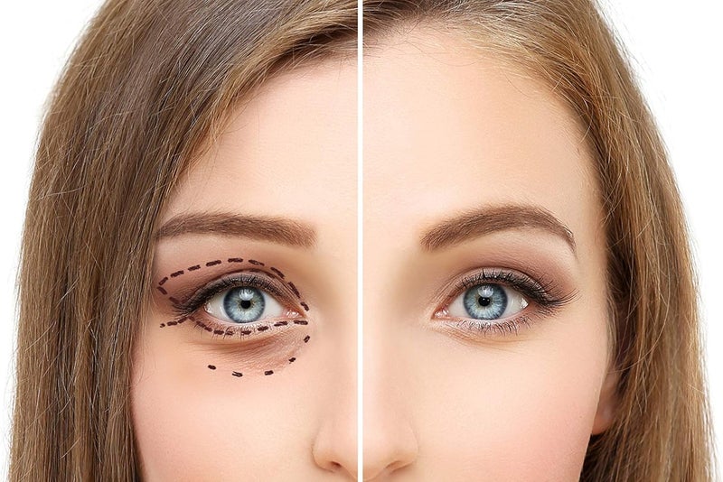 Osmotics Cosmeceuticals Under Eye Rejuvenator - Anti Aging Eye Cream for Dark Circles, Puffiness, and Fine Lines - Image 2