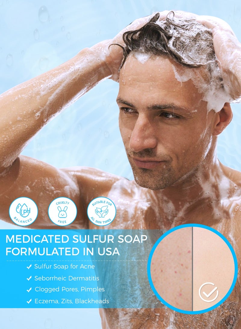 OUKEYA Sulphur Soap Cleansing Bar for Face & Body Natural Sulfur Facial Cleanser With Salicylic Acid Goat Milk and Tea Tree Oil for Acne-Prone Skin - Image 3