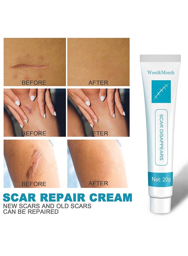 Skin Repair Cream,Scar Cream， dilute hyperplasia pregnancy surgery burn scald skin repair scar cream 20g
