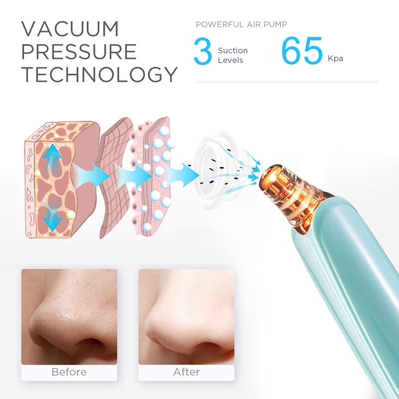 DIYthinker Blackhead Remover Pore Vacuum Cleaner - Upgraded Facial Pore Cleaner - Electric USB Pore Vacuum with 5 Probes - Upgraded Blackhead Suction Tool - Blackhead Remover Kit - Image 2